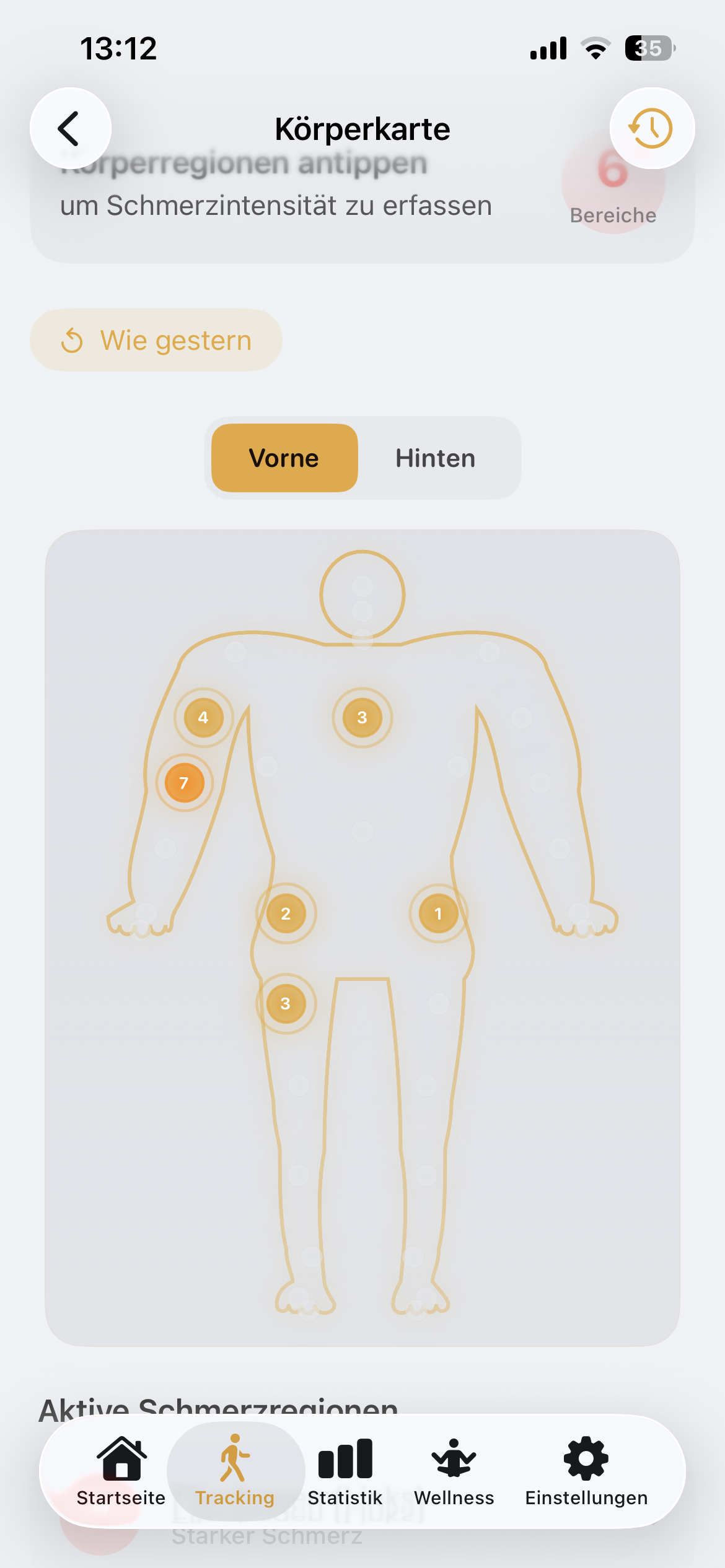 InflamAI Körperkarte